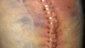 Severe injury suffered  by on-duty Kilkenny garda revealed by Garda Representative Association