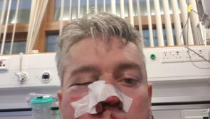 'Racist remarks' claim as man pays €5,000 compensation for referee assault