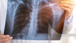 Flu vaccine advice issued to Kilkenny people with COPD condition