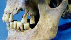 Dental remains exhumed in Kilkenny have revealed a lot about Famine diets