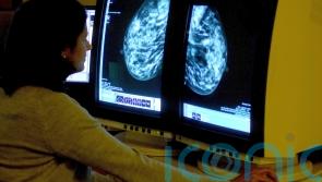 HSE says &lsquo;problem&rsquo; with viewing BreastCheck register will be fixed next week