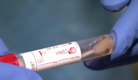 More than 10,000 Covid cases confirmed today as restrictions end