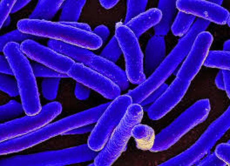 Failures of E Coli standards in two private water schemes in Kilkenny