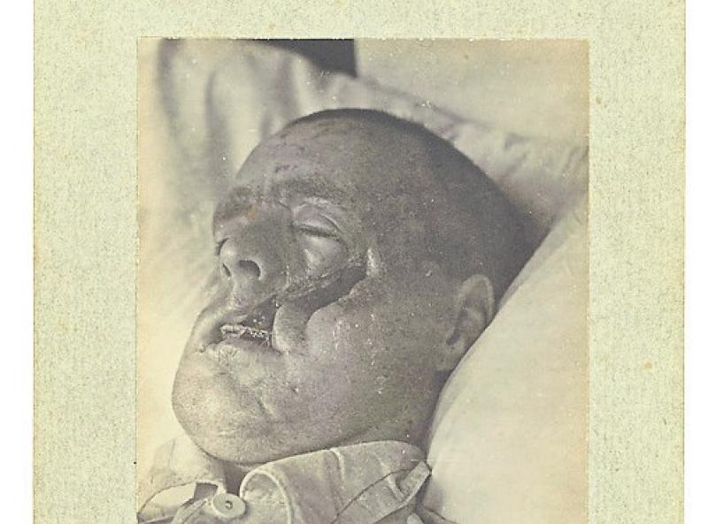 The life and times of Kilkenny man Herbert Foxton during and after World War I