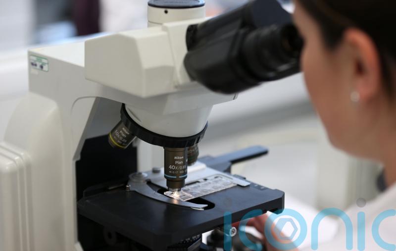 BREAKING: First monkeypox case identified in Ireland, HSE confirms